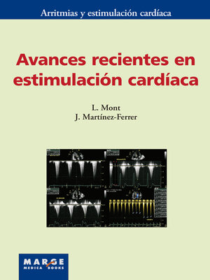 cover image of Avances recientes en estimulación cardíaca